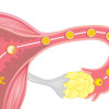 Memprediksi Ovulasi pada Menstruasi Ireguler