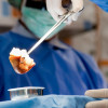 Povidone Iodine vs Chlorhexidine Gluconate dalam Alkohol untuk Antisepsis Kulit Sebelum Operasi – Telaah Jurnal Alomedika