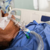Profilaksis Ulkus Stres selama Ventilasi Mekanik Invasif – Telaah Jurnal Alomedika