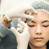Injeksi Kortikosteroid Intralesi untuk Acne Vulgaris