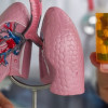 Peran Antibiotik dalam Manajemen Infark Paru