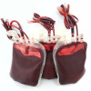 Pedoman Tata Laksana Transfusion-Dependent β-Thalassemia – Ulasan Guideline Terkini
