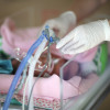 Kafein, Teofilin, atau Aminofilin untuk Apnea pada Bayi Preterm