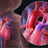 Terapi Konservatif vs Medikamentosa pada Patent Ductus Arteriosus Bayi Prematur – Telaah Jurnal Alomedika