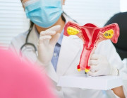 Metformin axcount 850 mg