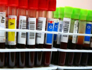 Can Your Blood Type Influence Your Personality?