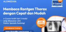 E-Course Membaca Rontgen Thorax dengan Cepat dan Mudah