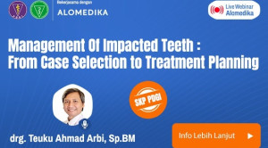 Live Webinar: Management Of Impacted Teeth: From Case Selection to Treatment Planning