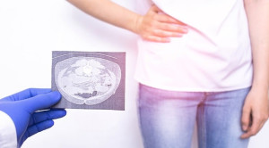 Penggunaan Antibiotik vs Appendectomy untuk Appendicitis – Telaah Jurnal Alomedika
