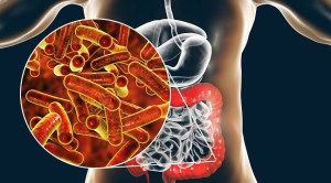 Mekanisme Resistensi Terhadap Antibiotik Empiris pada Infeksi Shigella Spp