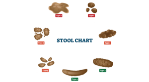 7 ลักษณะอุจจาระ บอกสัญญาณสุขภาพ