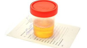 Urinalisis untuk Mendeteksi Infeksi Saluran Kemih pada Bayi Usia Kurang Dari 60 Hari