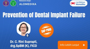 Live Webinar: Prevention of Dental Implant Failure