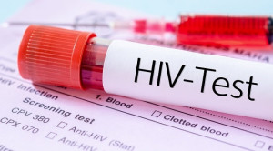 Perkembangan Pemeriksaan Serologi HIV