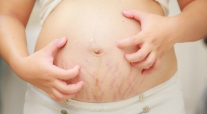 Asam Ursodeoksikolat versus Plasebo pada Wanita Hamil dengan Kolestasis Intrahepatik (PITCHES): Percobaan Acak Terkontrol- Telaah Jurnal