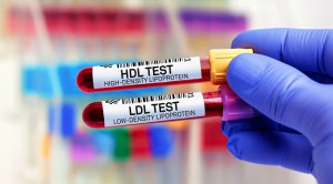 Yang Baru dari Pedoman Dislipidemia American Heart Association (AHA) 2018