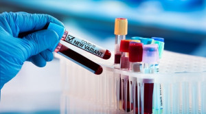 Mutasi Virus COVID-19: Variant Of Concern (VOC), Variant Of Interest (VOI), dan Variant Under Monitoring (VUM)