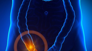 Pemeriksaan Appendicogram untuk Diagnosis Appendisitis