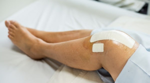 Profilaksis Deep Vein Thrombosis pada Prosedur Hip atau Knee Replacement