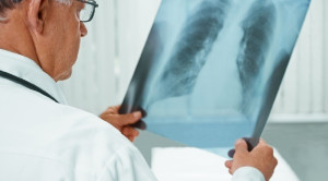 Pengaruh Diabetes Mellitus Terhadap Prognosis Tuberkulosis