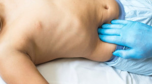 Efektivitas Observasi Aktif Vs Apendektomi Interval pada Pasien Anak dengan Massa Apendiks (Studi CHINA): Sebuah Uji Acak Terkontrol Open-Label—Telaah Jurnal Alomedika