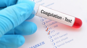 Peran Parameter Prothrombin Time (PT) dan Activated Partial Thromboplastin Time (APTT)