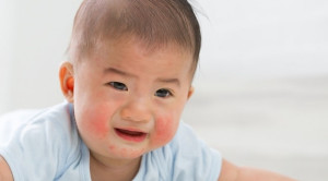 Keseimbangan Mikrobiota Usus: Peran Sinbiotik untuk Mencegah Alergi pada Anak