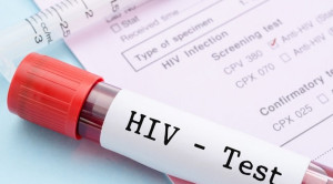 Rekomendasi Pemeriksaan HIV Menurut WHO