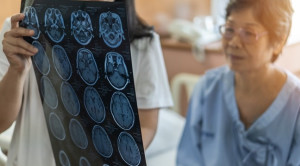 Kriteria NIHSS untuk Menilai Keparahan Stroke