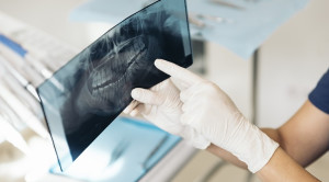 Peran Dokter Gigi dalam Tahap Antemortem