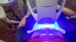 Terapi Laser Sebagai Perawatan Hipersensitivitas Dentin