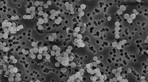 Pencegahan Transmisi MRSA di Rumah Sakit