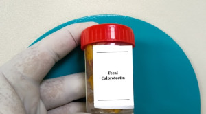 Interpretasi Panel Fecal Calprotectin
