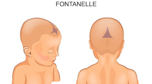 Kaitan Ubun-Ubun Menonjol pada Bayi Demam dengan Meningitis