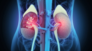 Menunda Perkembangan Penyakit Ginjal Kronik – Ulasan Guideline Terkini