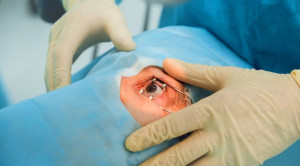 Perbandingan LASIK dan KLEx: Efikasi dan Keamanan