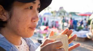 Pemberian Lactoferrin Oral pada Terapi Acne Vulgaris