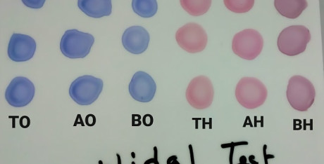 Super gozal qiz jinsiy aloqada