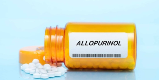Kapan Terapi Allopurinol Bisa Dihentikan?