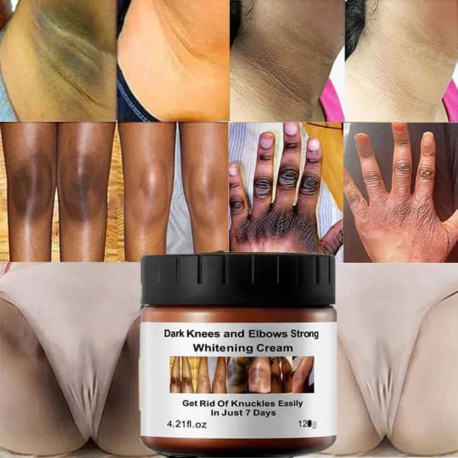 Dark Knees & Elbows Brightening Cream image 1