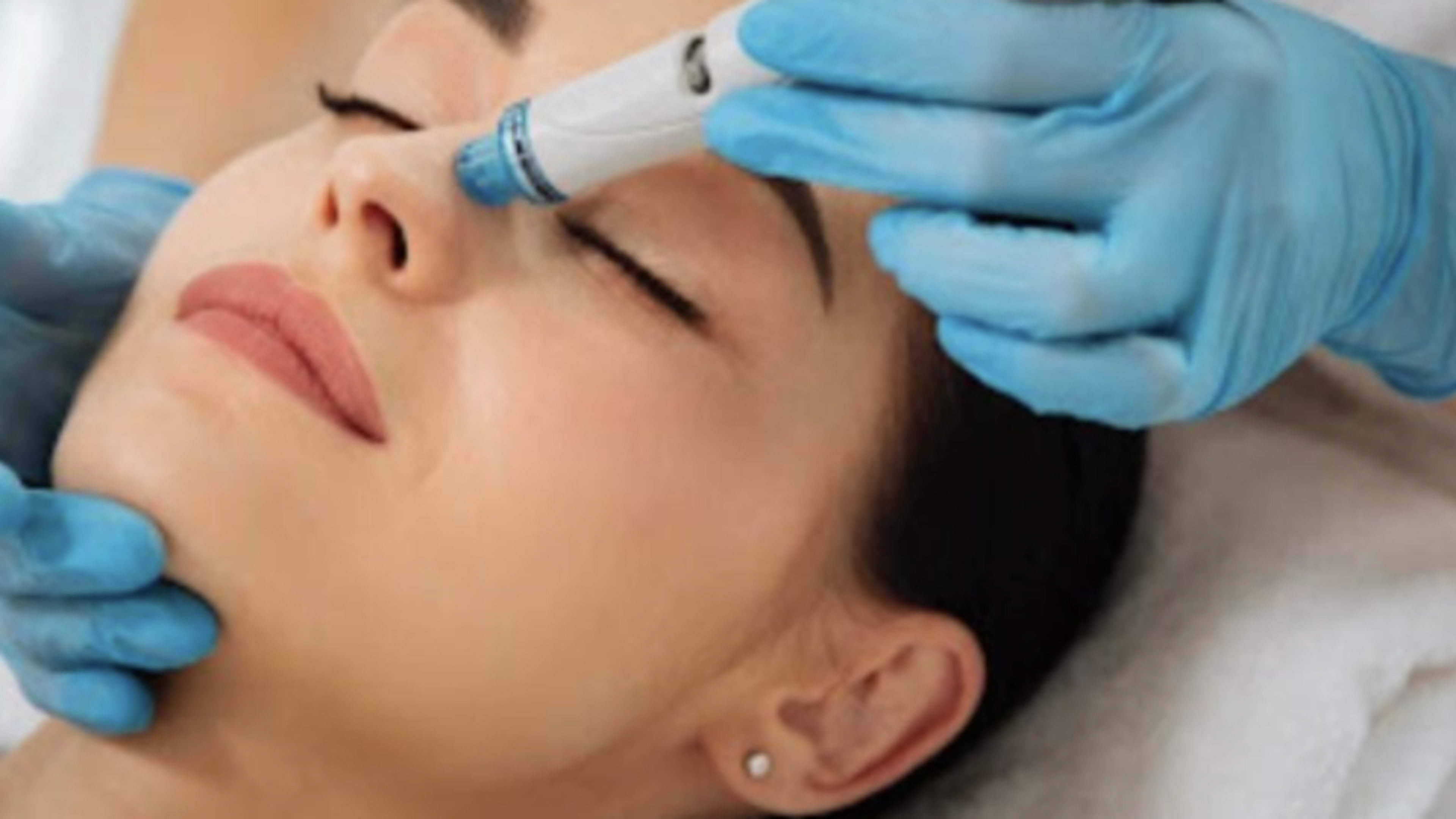 Medical-Grade HydraFacial — Just $129 (Reg. $199)