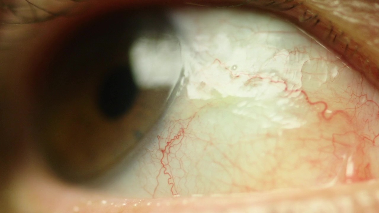 Storaro’s eye