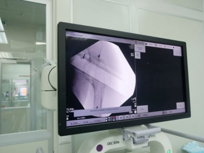 Успешная операция по установке 3D-импланта спасла мужчину из Свердловской области от ампутации