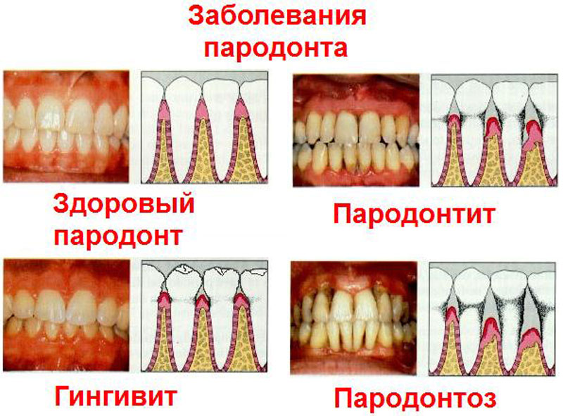 Перегрузка 6g что это ощущение