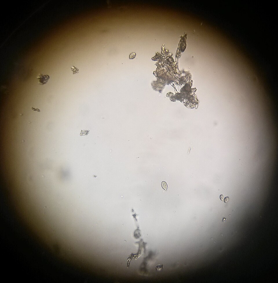 Downy Mildew Sporangia on LaCrosse Trap Plant 2015