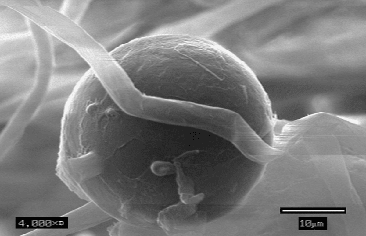 Chlamydospores - Reproductive Structure of the Phytophthora