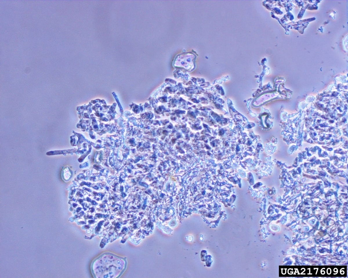 Rose powdery mildew conidia