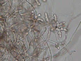 Pythium myriotylum