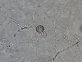 Pythium sulcatum