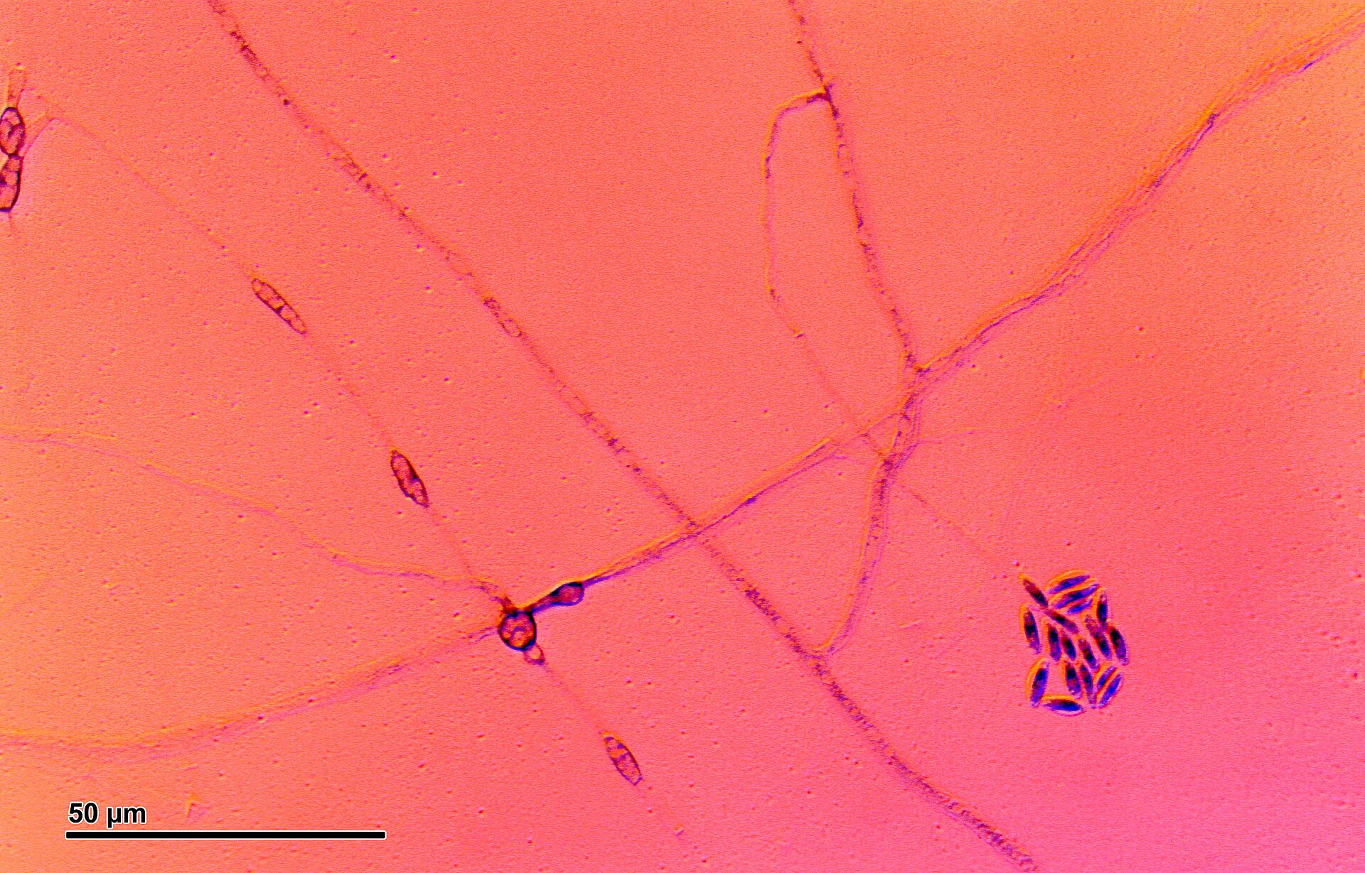 Pythium (248 24)
